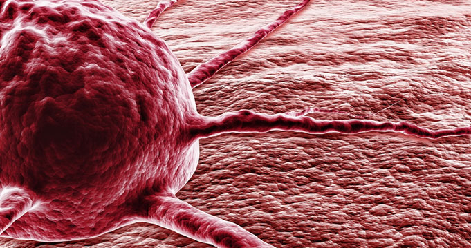 áttétes rák normális cbc szemölcsökkel járó papilloma vírus