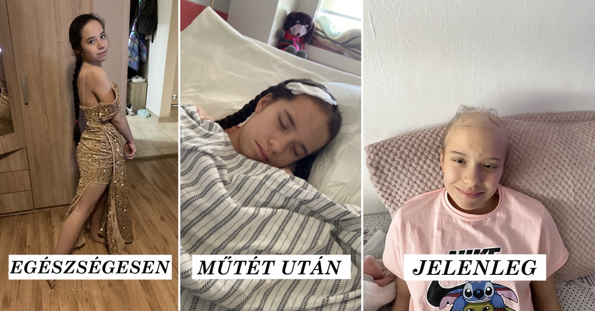 Anna agydaganattal küzd, testvére meghalt