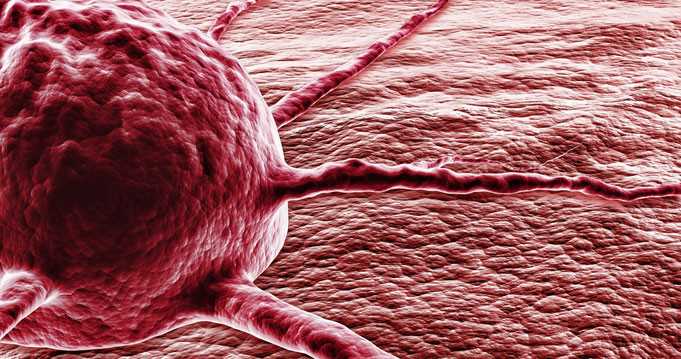daganatos rákos szarkóma rák genetikai tanácsadó munkaköri leírása