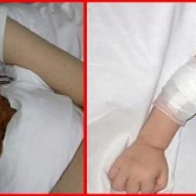 16 beteg gyermek részére: 504.092.- Ft adomány! Köszönjük! - alapítvány, adó 1%, támogatás