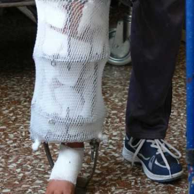 4,7 millió forintos Orthofix rendszer átadása a Semmelweis Egyetem Ortopédiai Klinikájának - adó, 1%, alapítvány, támogatás