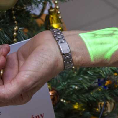 Adomány a Szegedi Gyermekgyógyászati Klinika számára - alapítvány, adó 1%, támogatás