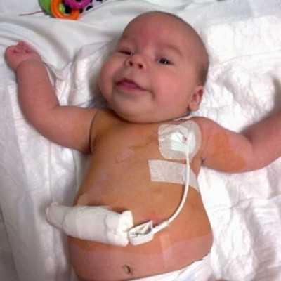 Célzott támogatás 2014. októberben - alapítvány, adó 1%, támogatás