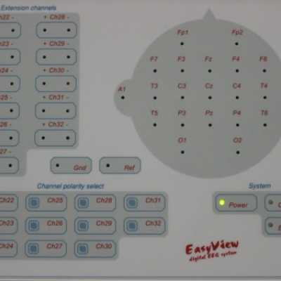EEG készülék átadása a DE OEC Gyermekgyógyászati Intézetében - adó, 1%, alapítvány, támogatás