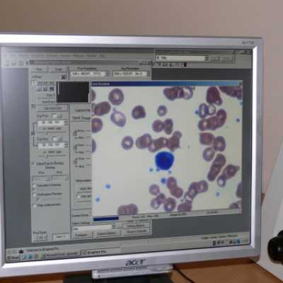 Mikroszkóp feltét átadása a Szt. István és Szt. László Kórházba - adó, 1%, alapítvány, támogatás