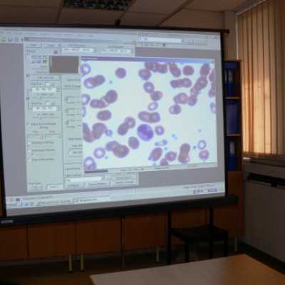 Mikroszkóp feltét átadása a Szt. István és Szt. László Kórházba - adó, 1%, alapítvány, támogatás