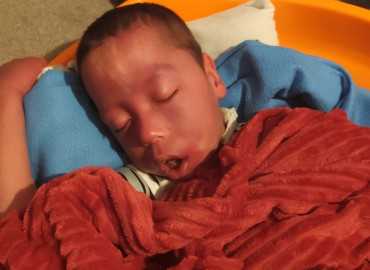 Ábel 3 hónapos korában agyvérzést kapott!