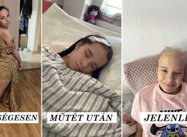 Anna agydaganattal küzd, testvére meghalt