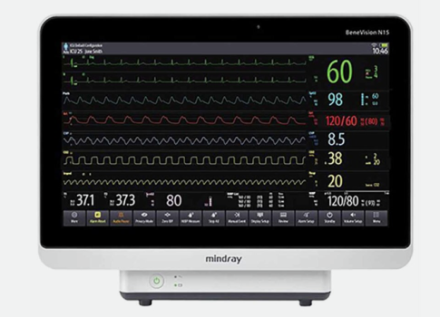 Mindray BeneVision N15 Patient Monitor beszerzésének támogatása valósult meg